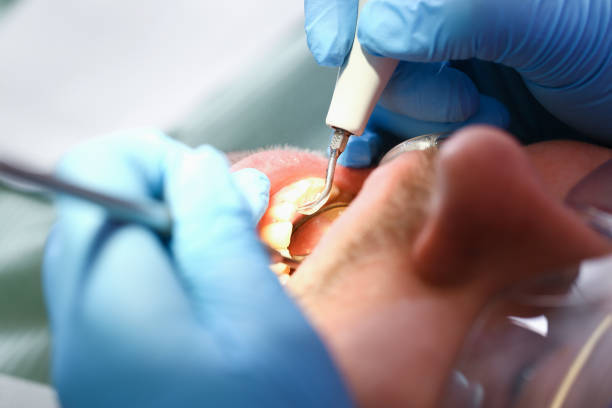 Best Emergency Gum Treatment in Morris, IL
