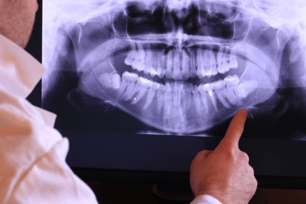 Best After-Hours Dental Trauma Care in Morris, IL